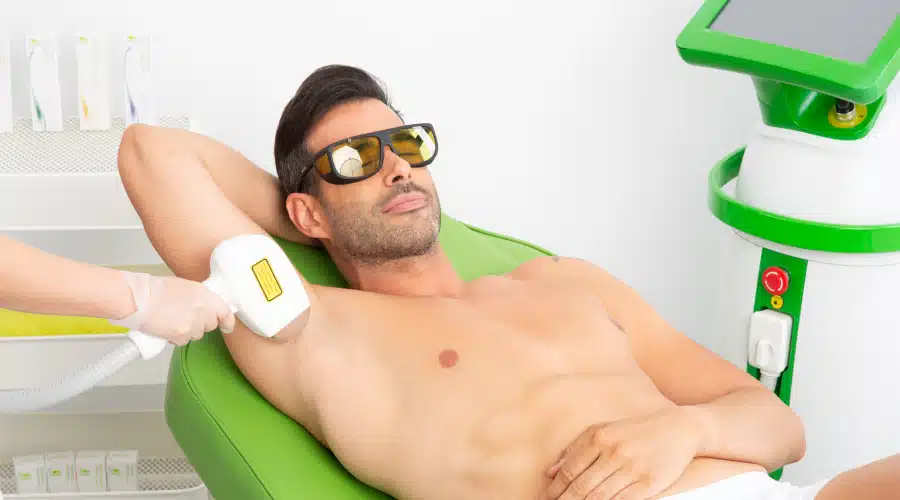 depilacion laser hombres
