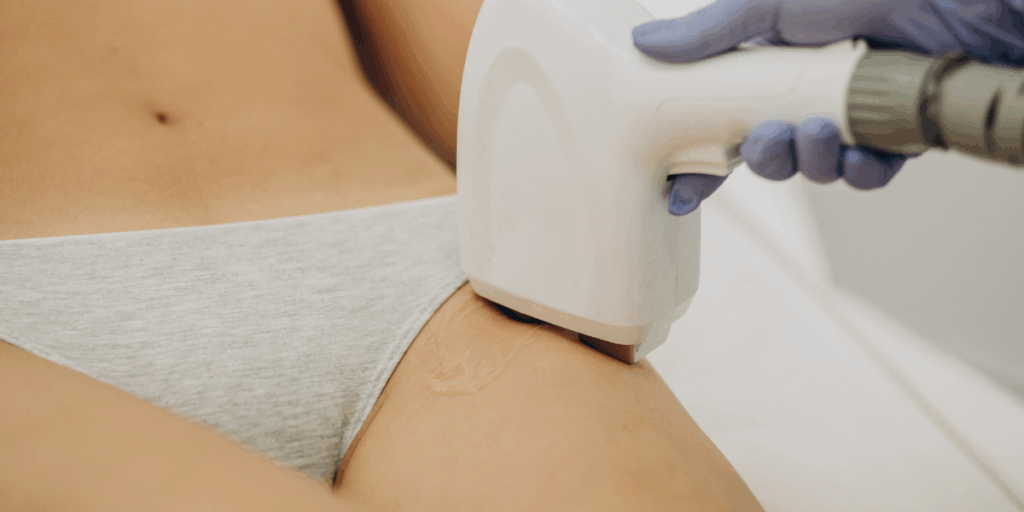 Fototermólisis selectiva. Qué es y cómo funciona en la depilación láser 1 Fototermólisis selectiva